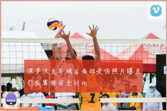 保罗沃克车祸后面部受伤照片曝光引发赛场安全讨论