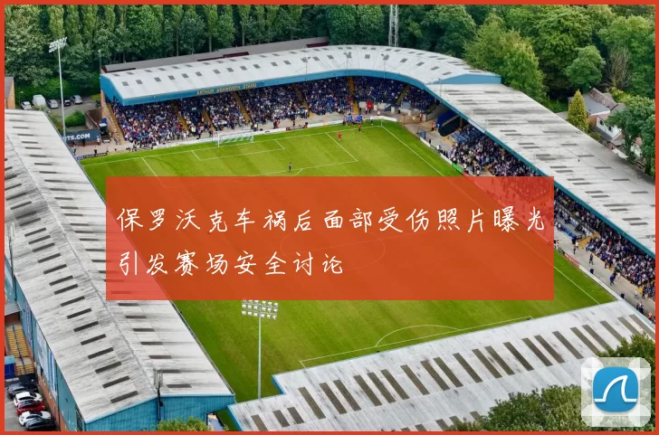 保罗沃克车祸后面部受伤照片曝光引发赛场安全讨论